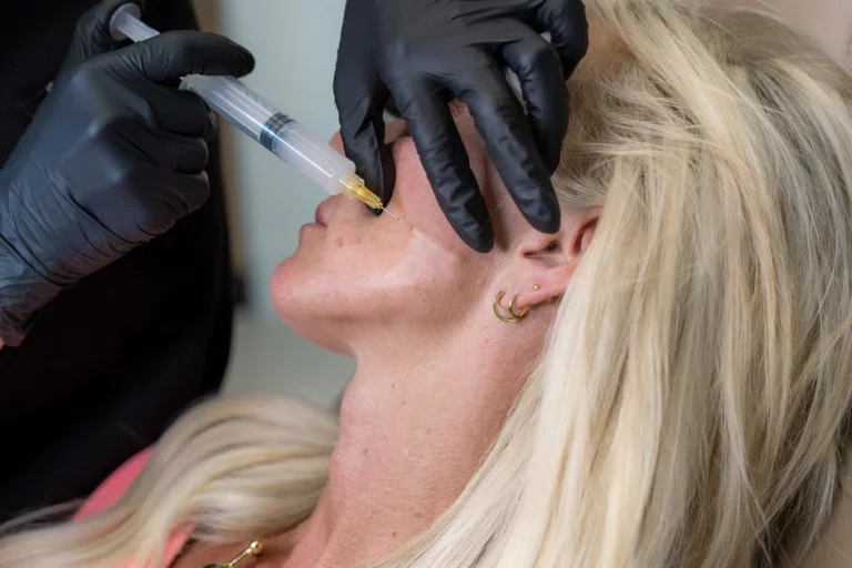 What is Sculptra and how long does it last