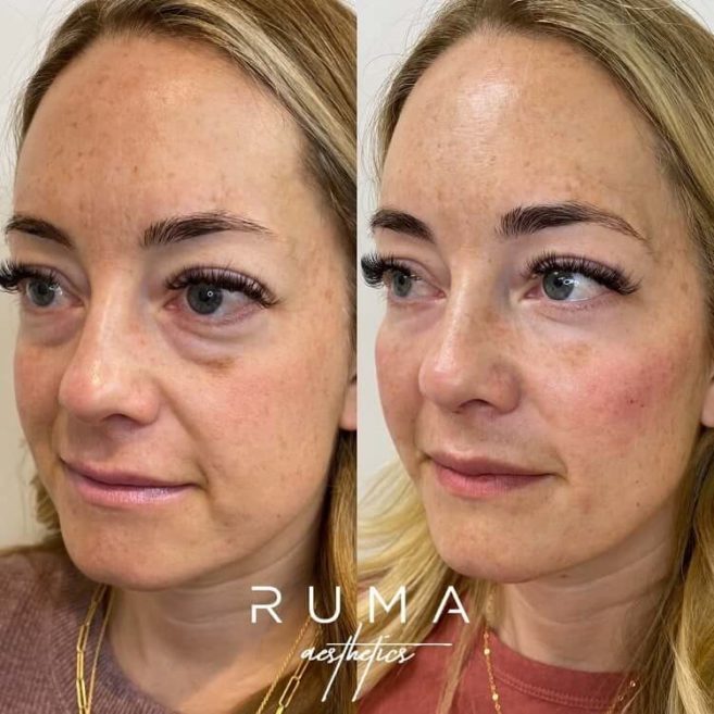 Ruma Medical Ruma Medical