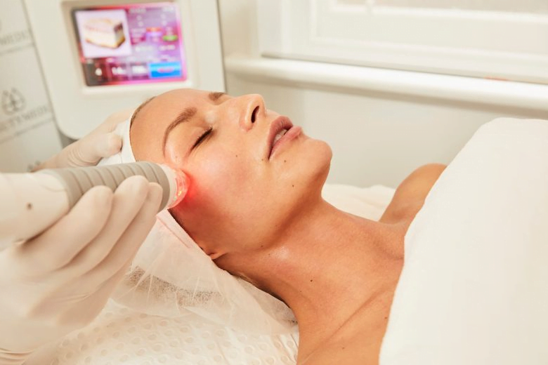 RUMA’S Vivace Microneedling With Radiofrequency Treatment RUMA’S Vivace Microneedling With Radiofrequency Treatment
