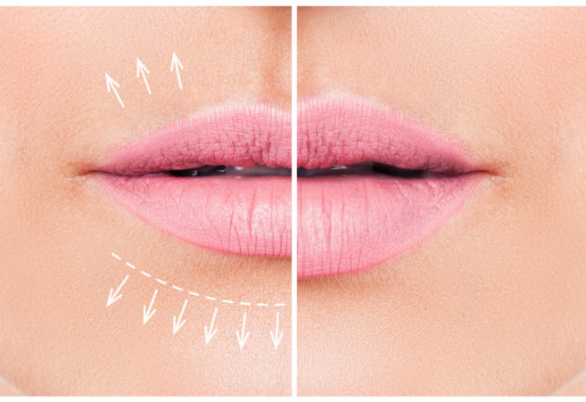 Love your lips! Love your lips!