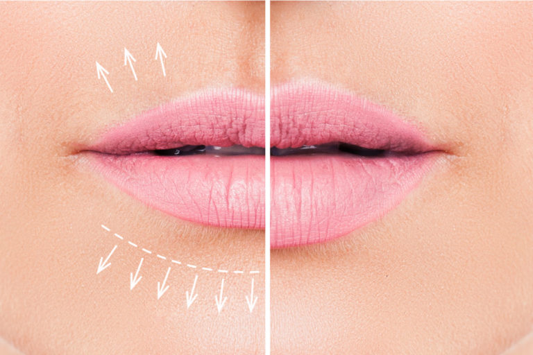 Love your lips!