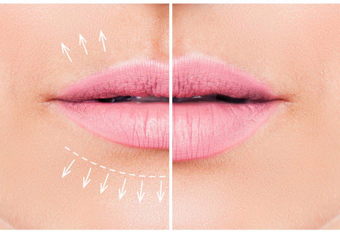 Love your lips!