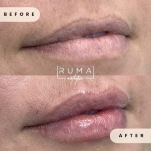 Love your lips!