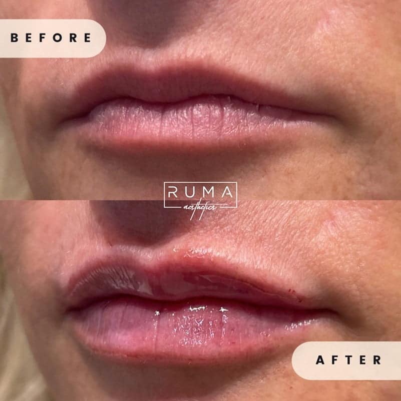 Love your lips!