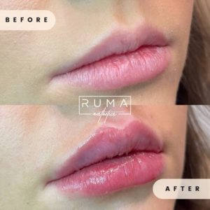 Love your lips!