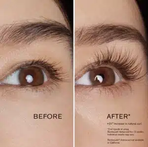 Brow gel before and after UT Ruma Medical Brow gel before and after UT Ruma Medical
