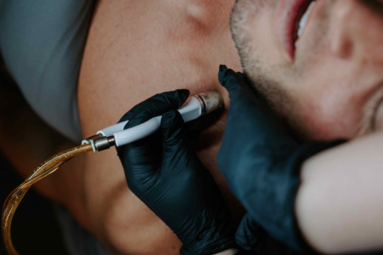Shine bright this Summer with a RUMA Diamond Facial