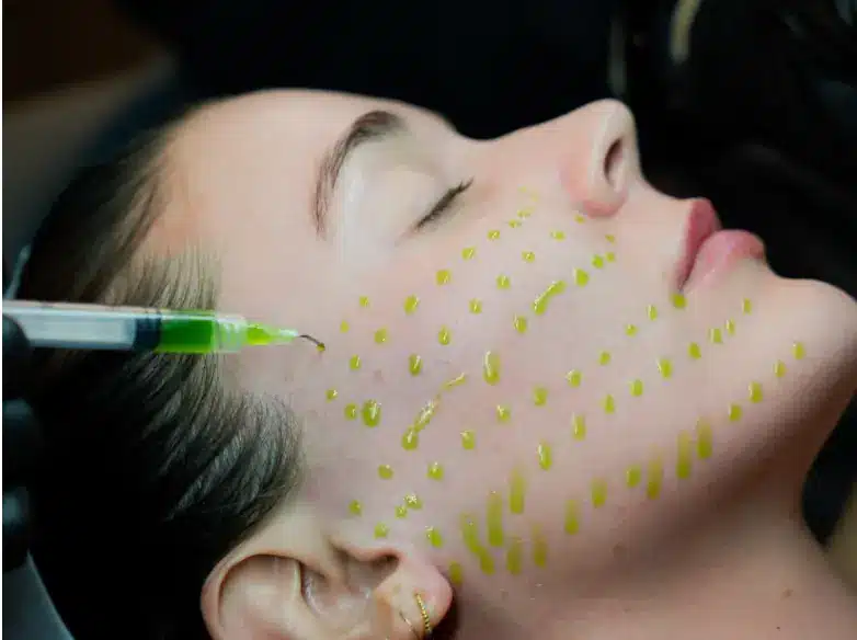 BioRePeel by RUMA Medical in Ashton