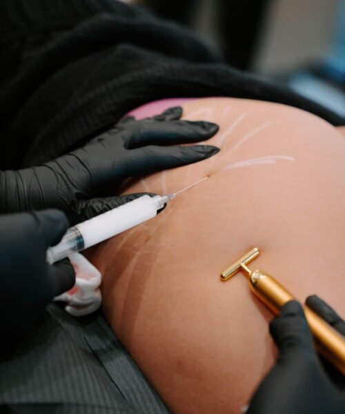 BOTOX & DYSPORT INJECTABLE IN LEHI, UT