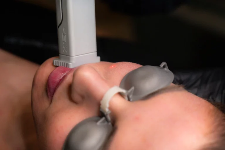 Helix Laser Resurfacing: Customizable Skin Rejuvenation