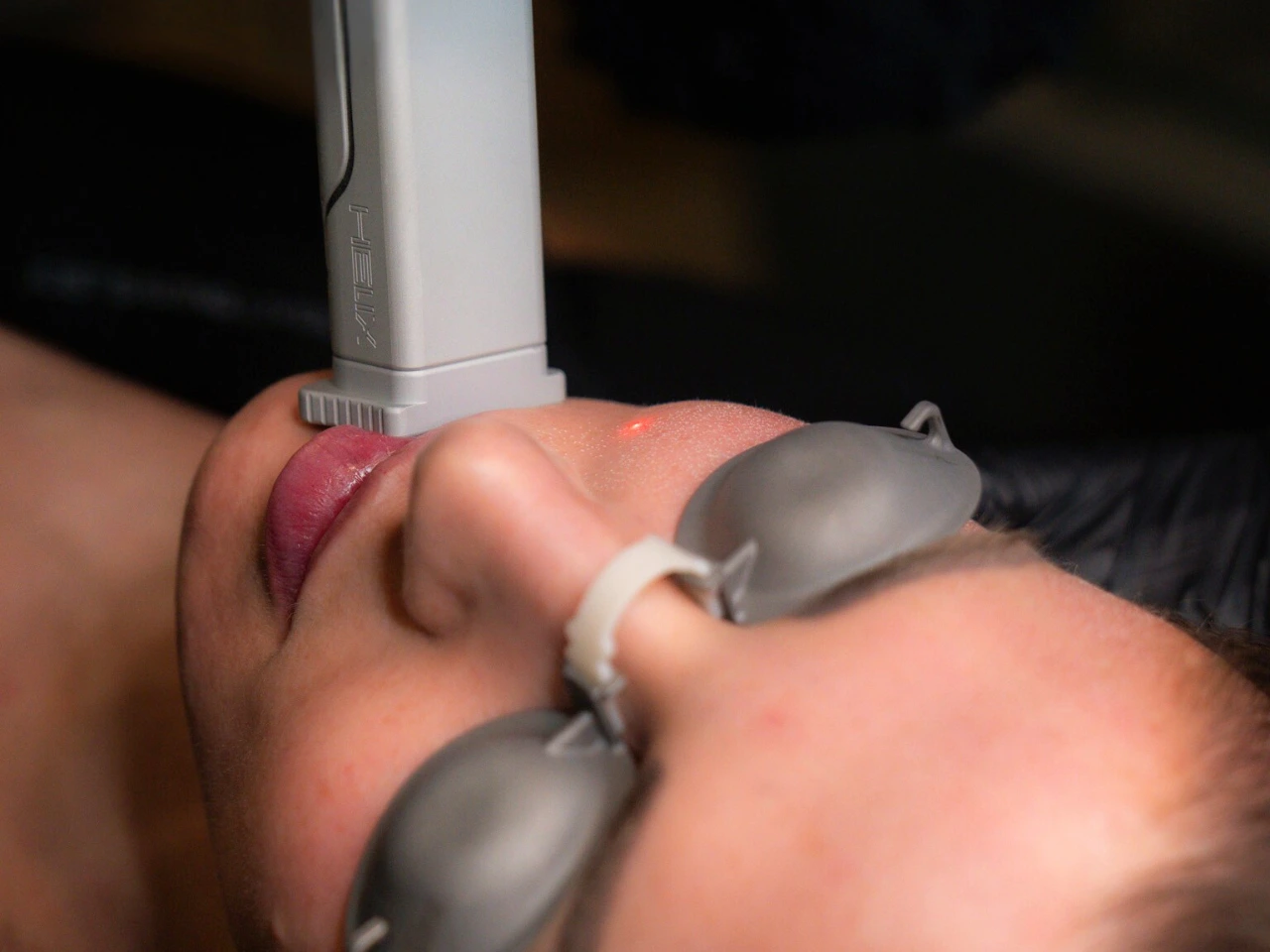 Helix Laser Resurfacing: Customizable Skin Rejuvenation Helix Laser Resurfacing: Customizable Skin Rejuvenation