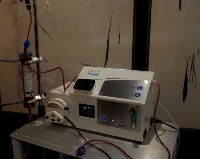 EBOO & Ozone Therapy: An Innovative Approach to Wellness EBOO & Ozone Therapy: An Innovative Approach to Wellness